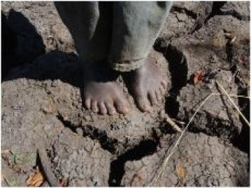http://weshare.unicef.org/Browse/Highlights/UNICEF-Resources-for-Media/Climate-Change-and-the-Impact-on-Children/Climate-Change---Photos